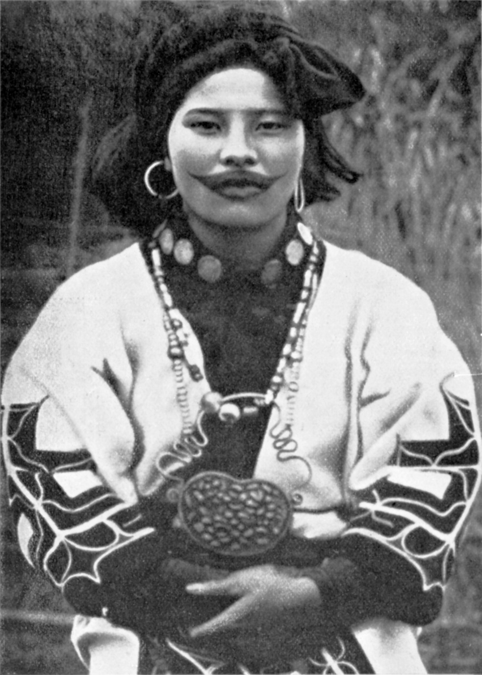 Ainu woman with traditional tattoos around the mouth